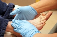 The Importance of Practicing Foot Care for Diabetic Patients